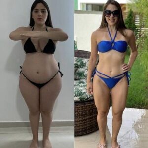 antes&depois2